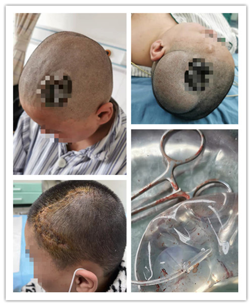 1637830936190587.jpg 术前_副本.jpg